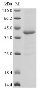 (Tris-Glycine gel) Discontinuous SDS-PAGE (reduced) with 5% enrichment gel and 15% separation gel.