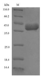 (Tris-Glycine gel) Discontinuous SDS-PAGE (reduced) with 5% enrichment gel and 15% separation gel.