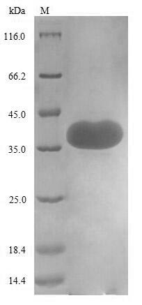 (Tris-Glycine gel) Discontinuous SDS-PAGE (reduced) with 5% enrichment gel and 15% separation gel.