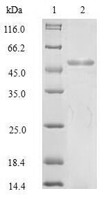 (Tris-Glycine gel) Discontinuous SDS-PAGE (reduced) with 5% enrichment gel and 15% separation gel.