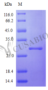 Interferon Alpha-2 Protein (IFNA2) partial, (Active) Tag-Free (E. coli-derived, recombinant human)