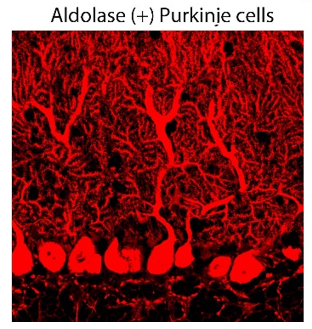 Aldolase C (ZebrinII) pAb (Go)