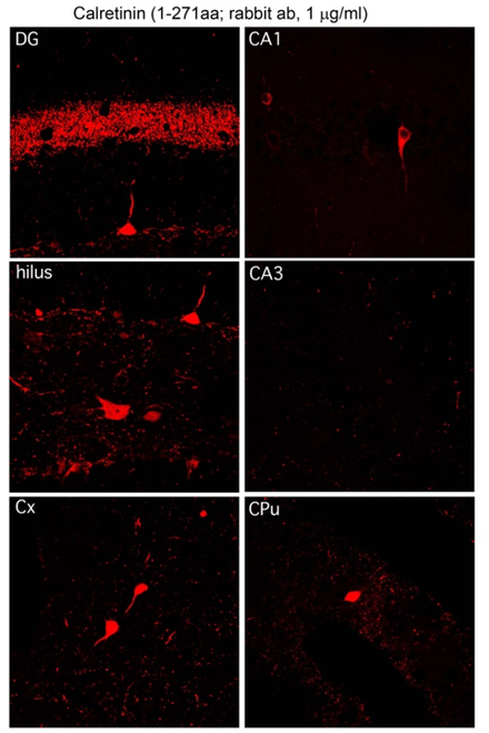 Calretinin pAb (Rb)