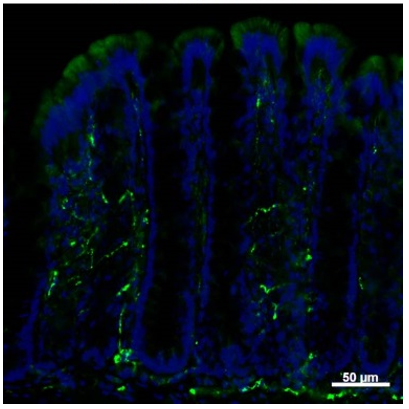 FFA3 (GPR41) pAb (Rb)