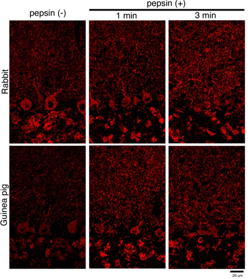 GABAA receptor-a1 pAb (GP)