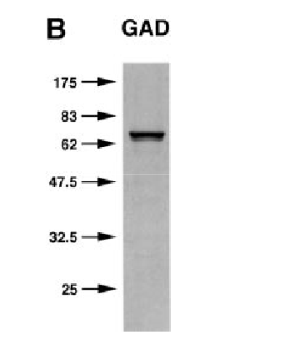 GAD67/65 pAb (Rb)