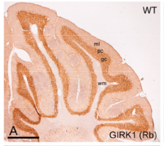 GIRK1 pAb (Rb)