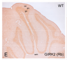 GIRK2 pAb (Rb)