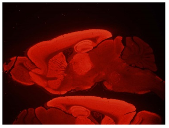 GluN2B,N-term (NR2B) pAb (Rb)