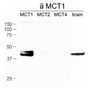 MCT1 pAb (GP)