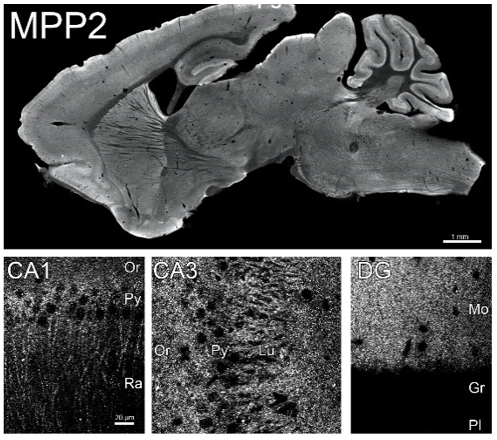 MPP2 (116-145) pAb (Rb)