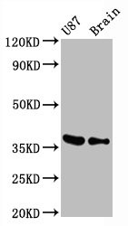 Western Blot<br />Positive WB detected in U87 whole cell lysate锛孧ouse brain tissue<br />All lanes GAPDH antibody at 0.31μg/ml<br />Secondary<br />Goat polyclonal to rabbit IgG at 1/50000 dilution<br />Predicted band size: 36 KDa<br />Observed band size: 36 KDa<br />
