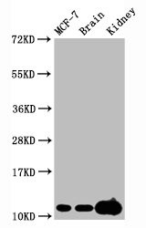 Western Blot<br />Positive WB detected in MCF-7 whole cell lysate锛孧ouse brain tissue,Mouse kidney tissue<br />All lanes Tri-methyl-Histone H4 (K20) antibody at 2.15μg/ml<br />Secondary<br />Goat polyclonal to rabbit IgG at 1/50000 dilution<br />Predicted band size: 11 KDa<br />Observed band size: 11 KDa<br />