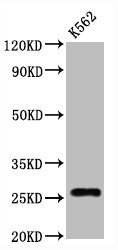 Western Blot<br />Positive WB detected in:K562 whole cell lysate<br />All lanes:CD81 antibody at 1.25μg/ml<br />Secondary<br />Goat polyclonal to rabbit IgG at 1/50000 dilution<br />Predicted band size: 26 KDa<br />Observed band size: 26 KDa