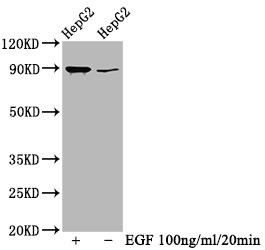 Western Blot<br />Positive WB detected in HepG2 whole cell lysate(treated with EGF or not)<br />All lanes Phospho-RPS6KA1 antibody at 0.69μg/ml<br />Secondary<br />Goat polyclonal to rabbit IgG at 1/50000 dilution<br />Predicted band size: 90 KDa<br />Observed band size: 90 KDa<br />
