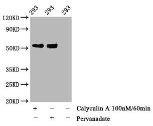 Western Blot<br />Positive WB detected in 293 whole cell lysate(treated with Calyculin A or Pervanadate)<br />All lanes Phospho-TP53 antibody at 1.28μg/ml<br />Secondary<br />Goat polyclonal to rabbit IgG at 1/50000 dilution<br />Predicted band size: 53 KDa<br />Observed band size: 53 KDa<br />