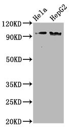 Western Blot<br />Positive WB detected in Hela whole cell lysate,HepG2 whole cell lysate<br />All lanes Phospho-NBN antibody at 1.98μg/ml<br />Secondary<br />Goat polyclonal to rabbit IgG at 1/50000 dilution<br />Predicted band size: 95 KDa<br />Observed band size: 95 KDa<br />