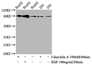 Western Blot<br />Positive WB detected in HepG2 whole cell lysate,293 whole cell lysate(treated with Calyculin A or EGF)<br />All lanes Phospho-NFE2L2 antibody at 0.8μg/ml<br />Secondary<br />Goat polyclonal to rabbit IgG at 1/50000 dilution<br />Predicted band size: 90 KDa<br />Observed band size: 90 KDa<br />