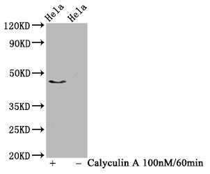 Western Blot<br />Positive WB detected in Hela whole cell lysate(treated with Calyculin A or not)<br />All lanes Phospho-IRF3 antibody at 1.03μg/ml<br />Secondary<br />Goat polyclonal to rabbit IgG at 1/50000 dilution<br />Predicted band size: 47 KDa<br />Observed band size: 47 KDa<br />