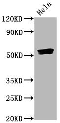 Western Blot<br />Positive WB detected in Hela whole cell lysate<br />All lanes Phospho-SMAD5 antibody at 0.835μg/ml<br />Secondary<br />Goat polyclonal to rabbit IgG at 1/50000 dilution<br />Predicted band size: 52 KDa<br />Observed band size: 52 KDa<br />