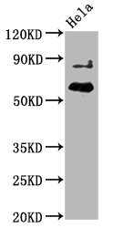 Western Blot<br />Positive WB detected in Hela whole cell lysate<br />All lanes Phospho-AKT1 antibody at 2.25μg/ml<br />Secondary<br />Goat polyclonal to rabbit IgG at 1/50000 dilution<br />Predicted band size: 60 KDa<br />Observed band size: 60 KDa<br />
