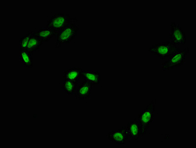 Immunofluorescence staining of Hela with CSB-RA019284A43phHU at 1:100,counter-stained with DAPI. The cells were fixed in 4% formaldehyde, permeabilized using 0.2% Triton X-100 and blocked in 10% normal Goat Serum. The cells were then incubated with the antibody overnight at 4℃. The secondary antibody was Alexa Fluor 488-congugated AffiniPure Goat Anti-Rabbit IgG (H+L).