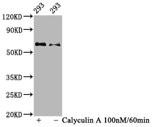 Western Blot<br />Positive WB detected in 293 whole cell lysate(treated with Calyculin A or not)<br />All lanes Phospho-AKT1 antibody at 1.08μg/ml<br />Secondary<br />Goat polyclonal to rabbit IgG at 1/50000 dilution<br />Predicted band size: 60 KDa<br />Observed band size: 60 KDa<br />