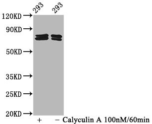 Western Blot<br />Positive WB detected in 293 whole cell lysate(treated with Calyculin A or not)<br />All lanes Phospho-PAK4/PAK5/PAK6 antibody at 2.15μg/ml<br />Secondary<br />Goat polyclonal to rabbit IgG at 1/50000 dilution<br />Predicted band size: 64,75,80 KDa<br />Observed band size: 75,80 KDa<br />