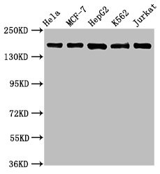 Western Blot<br />Positive WB detected in: Hela whole cell lysate, MCF-7 whole cell lysate, HepG2 whole cell lysate, K562 whole cell lysate, Jurkat whole cell lysate<br />All lanes: HDAC6 antibody at 1.1μg/ml<br />Secondary<br />Goat polyclonal to rabbit IgG at 1/50000 dilution<br />Predicted band size: 132, 115 KDa<br />Observed band size: 160 KDa<br />