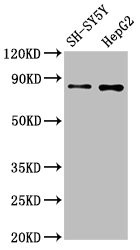 Western Blot<br />Positive WB detected in: SH-SY5Y whole cell lysate, HepG2 whole cell lysate<br />All lanes: GOLM1 antibody at 1.3μg/ml<br />Secondary<br />Goat polyclonal to rabbit IgG at 1/50000 dilution<br />Predicted band size: 46, 45 KDa<br />Observed band size: 80 KDa<br />