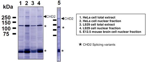 Immunoblot analysis of Hela and L929 cell extracts and E12.5 mouse brain extracts using CDH2 antibody (6D2).
