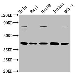 Western Blot<br />Positive WB detected in: Hela whole cell lysate, Raji whole cell lysate, HepG2 whole cell lysate, Jurkat whole cell lysate, MCF-7 whole cell lysate<br />All lanes: FEN1 antibody at 0.775μg/ml<br />Secondary<br />Goat polyclonal to rabbit IgG at 1/50000 dilution<br />Predicted band size: 43, 36 KDa<br />Observed band size: 43 KDa<br />