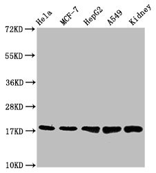 Western Blot<br />Positive WB detected in: Hela whole cell lysate, MCF-7 whole cell lysate, HepG2 whole cell lysate, A549 whole cell lysate, Mouse kidney tissue<br />All lanes: PBR antibody at 1.2μg/ml<br />Secondary<br />Goat polyclonal to rabbit IgG at 1/50000 dilution<br />Predicted band size: 19, 11 KDa<br />Observed band size: 19 KDa<br />