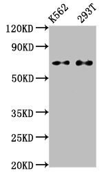 Western Blot<br />Positive WB detected in: K562 whole cell lysate, 293T whole cell lysate<br />All lanes: ATF2 antibody at 1.2μg/ml<br />Secondary<br />Goat polyclonal to rabbit IgG at 1/50000 dilution<br />Predicted band size: 55, 36, 24, 49, 53, 14, 25, 16 KDa<br />Observed band size: 70 KDa<br />