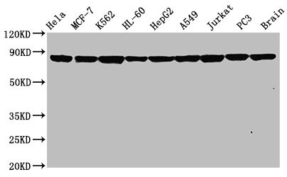 Western Blot<br />Positive WB detected in: Hela whole cell lysate, MCF-7 whole cell lysate, K562 whole cell lysate, HL-60 whole cell lysate, HepG2 whole cell lysate, A549 whole cell lysate, Jurkat whole cell lysate, PC3 whole cell lysate, Rat brain tissue<br />All lanes: Hsp90 alpha antibody at 0.8μg/ml<br />Secondary<br />Goat polyclonal to rabbit IgG at 1/50000 dilution<br />Predicted band size: 85, 99 KDa<br />Observed band size: 85 KDa<br />