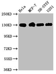 Western Blot<br />Positive WB detected in: Hela whole cell lysate, MCF-7 whole cell lysate, SH-SY5Y whole cell lysate, U251 whole cell lysate<br />All lanes: Integrin beta-1/CD29 antibody at 1.9μg/ml<br />Secondary<br />Goat polyclonal to rabbit IgG at 1/50000 dilution<br />Predicted band size: 89, 88, 92 KDa<br />Observed band size: 130 KDa<br />