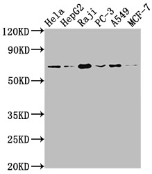 Western Blot<br />Positive WB detected in: Hela whole cell lysate, HepG2 whole cell lysate, Raji whole cell lysate, PC-3 whole cell lysate, A549 whole cell lysate, MCF-7 whole cell lysate<br />All lanes: ALAS1 antibody at 1:1500<br />Secondary<br />Goat polyclonal to rabbit IgG at 1/50000 dilution<br />Predicted band size: 71, 13 kDa<br />Observed band size: 71 kDa<br />