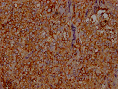 IHC image of CSB-RA575353A0HU diluted at 1:100 and staining in paraffin-embedded human adrenal gland tissue performed on a Leica BondTM system. After dewaxing and hydration, antigen retrieval was mediated by high pressure in a citrate buffer (pH 6.0). Section was blocked with 10% normal goat serum 30min at RT. Then primary antibody (1% BSA) was incubated at 4℃ overnight. The primary is detected by a Goat anti-rabbit IgG polymer labeled by HRP and visualized using 0.05% DAB.