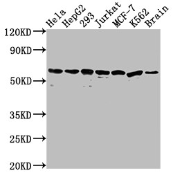 Western Blot<br />Positive WB detected in: Hela whole cell lysate, HepG2 whole cell lysate, 293 whole cell lysate, Jurkat whole cell lysate, MCF-7 whole cell lysate, K562 whole cell lysate, Mouse brain tissue<br />All lanes: HSPD1 antibody at 1:2000<br />Secondary<br />Goat polyclonal to rabbit IgG at 1/50000 dilution<br />Predicted band size: 62, 18 kDa<br />Observed band size: 60 kDa<br />
