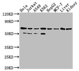 Western Blot<br />Positive WB detected in: Hela whole cell lysate, Jurkat whole cell lysate, A549 whole cell lysate, HepG2 whole cell lysate, MCF-7 whole cell lysate, Rat liver tissue, Rat kidney tissue<br />All lanes: AIFM1 antibody at 1:2000<br />Secondary<br />Goat polyclonal to rabbit IgG at 1/50000 dilution<br />Predicted band size: 67, 36, 29, 27 kDa<br />Observed band size: 67 kDa<br />