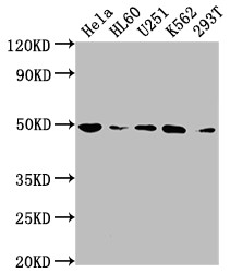 Western Blot<br />Positive WB detected in: Hela whole cell lysate, HL60 whole cell lysate, U251 whole cell lysate, K562 whole cell lysate, 293T whole cell lysate<br />All lanes: HDAC3 antibody at 1:2000<br />Secondary<br />Goat polyclonal to rabbit IgG at 1/50000 dilution<br />Predicted band size: 49, 50 kDa<br />Observed band size: 49 kDa<br />