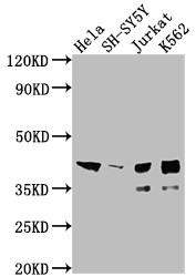 Western Blot<br />Positive WB detected in: Hela whole cell lysate, SH-SY5Y whole cell lysate, Jurkat whole cell lysate, K562 whole cell lysate<br />All lanes: ISL1 antibody at 1:2000<br />Secondary<br />Goat polyclonal to rabbit IgG at 1/50000 dilution<br />Predicted band size: 40 kDa<br />Observed band size: 39 kDa<br />