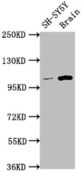 Western Blot<br />Positive WB detected in: SH-SY5Y whole cell lysate, Rat brain tissue<br />All lanes: LGR5 antibody at 1:1500<br />Secondary<br />Goat polyclonal to rabbit IgG at 1/50000 dilution<br />Predicted band size: 100, 98, 93 kDa<br />Observed band size: 100 kDa<br />
