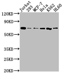 Western Blot<br />Positive WB detected in: Jurkat whole cell lysate, 293 whole cell lysate, MCF-7 whole cell lysate, Hela whole cell lysate, K562 whole cell lysate, HL60 whole cell lysate<br />All lanes: PTPN11 antibody at 1:2000<br />Secondary<br />Goat polyclonal to rabbit IgG at 1/50000 dilution<br />Predicted band size: 69, 53 kDa<br />Observed band size: 69 kDa<br />