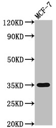 Western Blot<br />Positive WB detected in: MCF-7 whole cell lysate<br />All lanes: EPCAM antibody at 1:2000<br />Secondary<br />Goat polyclonal to rabbit IgG at 1/50000 dilution<br />Predicted band size: 35 kDa<br />Observed band size: 35 kDa<br />