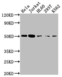 Western Blot<br />Positive WB detected in: Hela whole cell lysate, Jurkat whole cell lysate, HL60 whole cell lysate, 293T whole cell lysate, K562 whole cell lysate<br />All lanes: CASP2 antibody at 1:2000<br />Secondary<br />Goat polyclonal to rabbit IgG at 1/50000 dilution<br />Predicted band size: 51, 35, 11 kDa<br />Observed band size: 51 kDa<br />