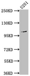 Western Blot<br />Positive WB detected in: U251 whole cell lysate<br />All lanes: MME antibody at 1:1500<br />Secondary<br />Goat polyclonal to rabbit IgG at 1/50000 dilution<br />Predicted band size: 86 kDa<br />Observed band size: 100 kDa<br />