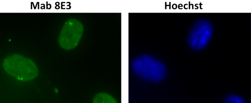 Immunocytochemistry/Immunofluorescence analysis of DHX9 /RNA helicaseA antibody (8E3) on mouse L929 cells.