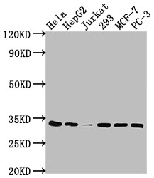 Western Blot<br />Positive WB detected in: Hela whole cell lysate, HepG2 whole cell lysate, Jurkat whole cell lysate, 293 whole cell lysate, MCF-7 whole cell lysate, PC-3 whole cell lysate<br />All lanes: CDK4 antibody at 1:2000<br />Secondary<br />Goat polyclonal to rabbit IgG at 1/50000 dilution<br />Predicted band size: 34, 21 kDa<br />Observed band size: 34 kDa<br />