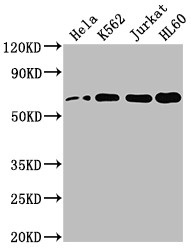 Western Blot<br />Positive WB detected in: Hela whole cell lysate, K562 whole cell lysate, Jurkat whole cell lysate, HL60 whole cell lysate<br />All lanes: HDAC1 antibody at 1:2000<br />Secondary<br />Goat polyclonal to rabbit IgG at 1/50000 dilution<br />Predicted band size: 56 kDa<br />Observed band size: 60 kDa<br />